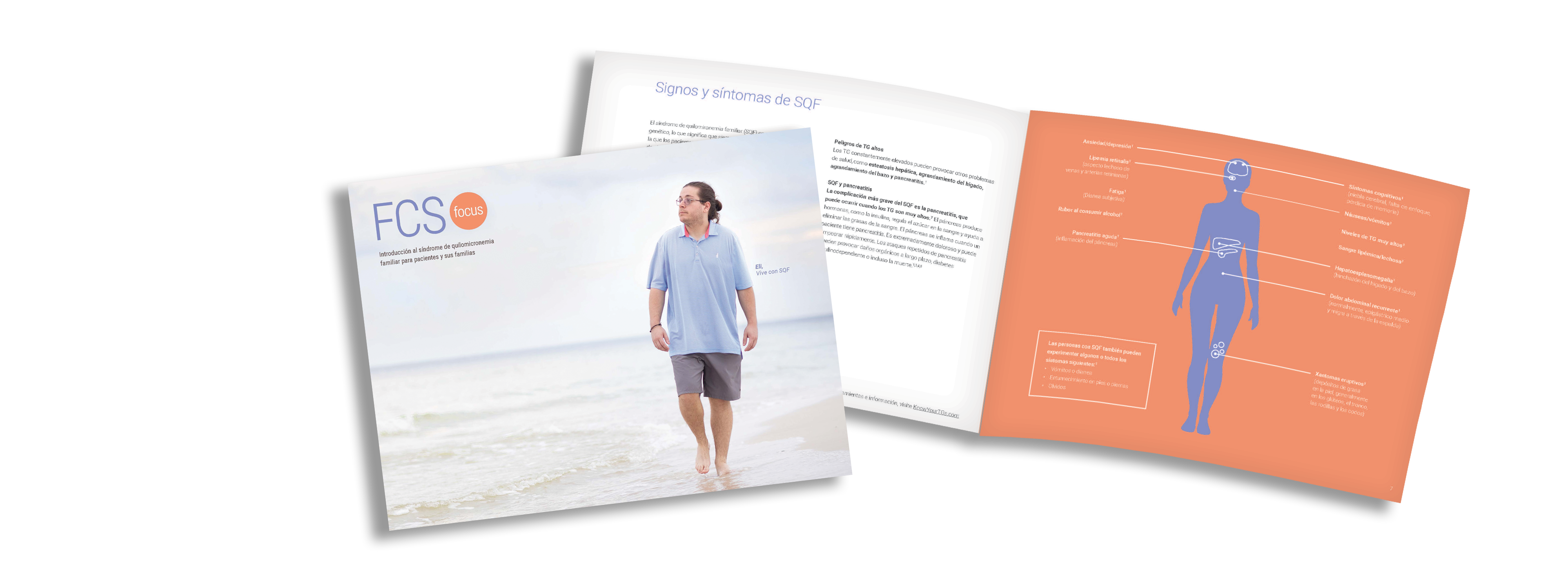 FCS Patient Guide Brochure